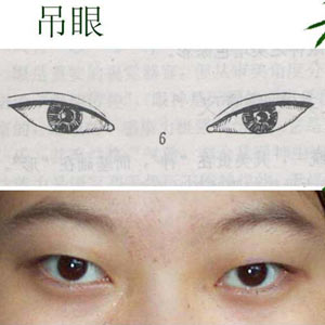 picture of slanted eyes