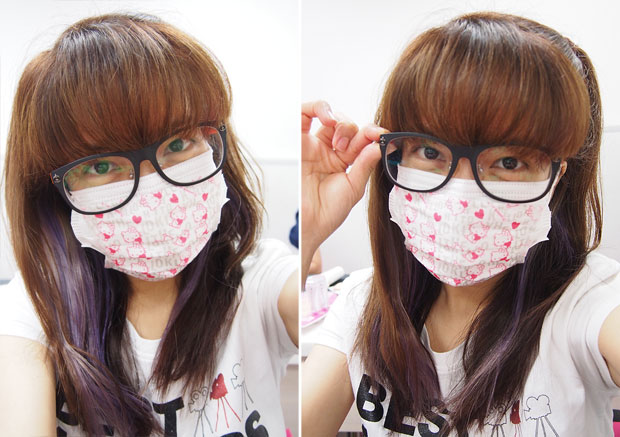 My-Skin-Ravaged-Allergic-Reaction-After-Facial-Experience_day-6-morning_5