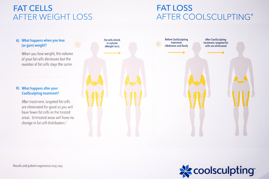 How-Slimming-CoolSculpting-Works_2