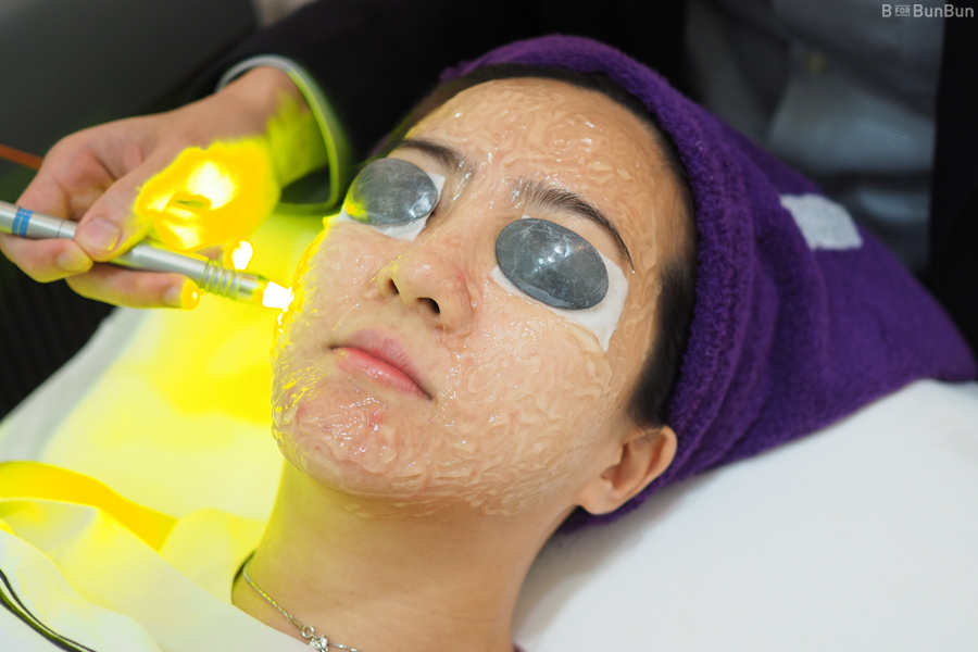 Tricks-For-Acne-Skin_3